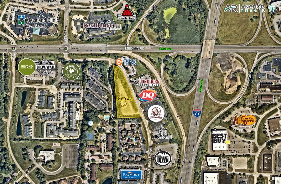 More Photos Of 110 Montrose West Ave, Akron Restaurant For Lease